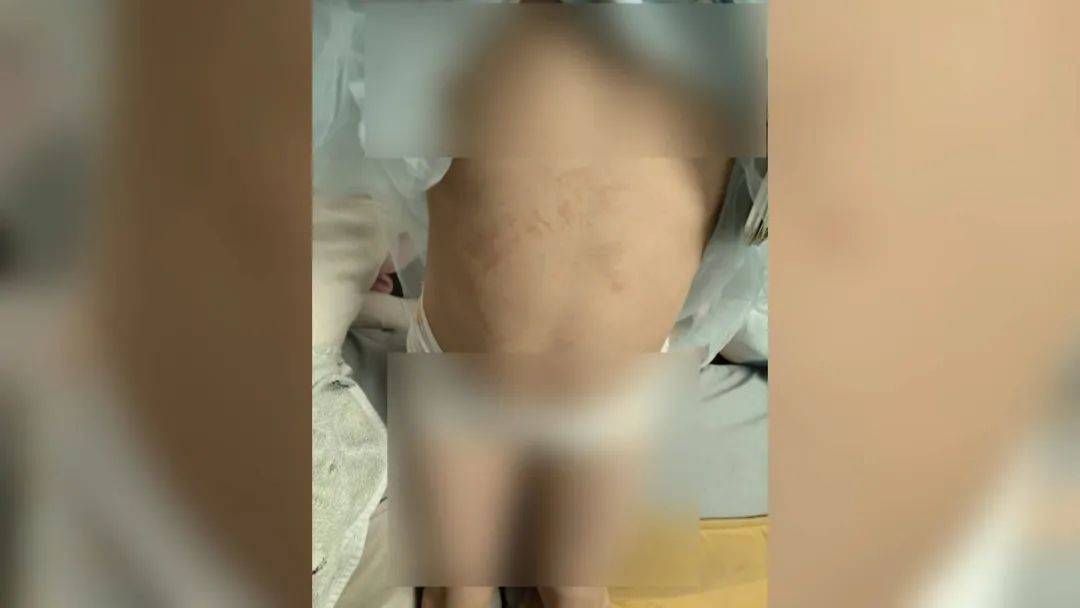 吓！南宁暴雨冲开井盖，儿童放学途中不慎掉下去！防坠网救大命了……