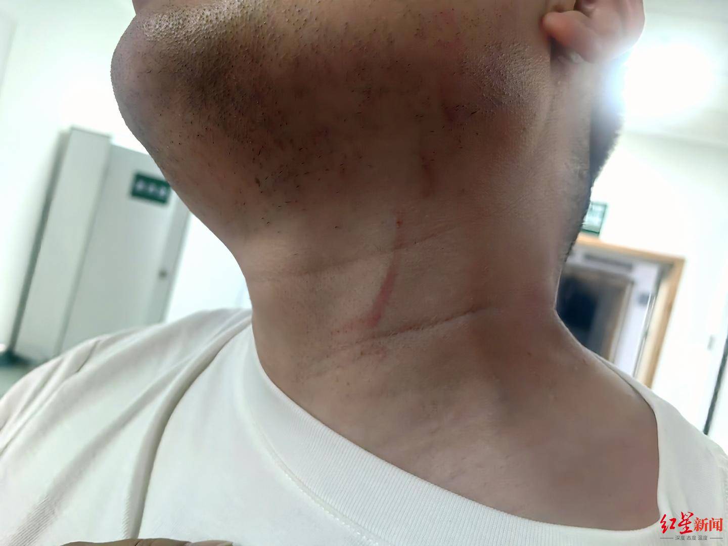 武汉男子拍摄违停时被当街殴打，打人者被罚款500元，被打者称将提起行政复议并起诉